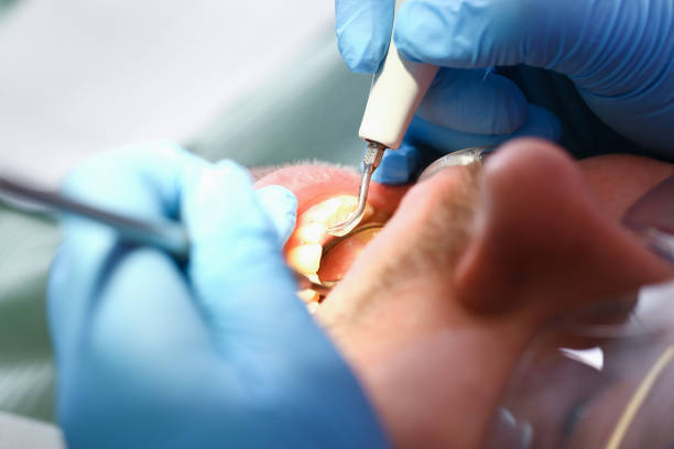 Best Emergency Dental Services for Seniors in Milford Square, PA