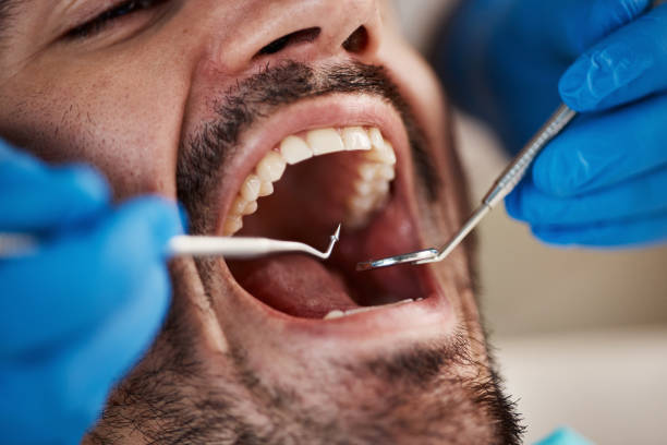 Best Mobile Emergency Dentist in Milford Square, PA