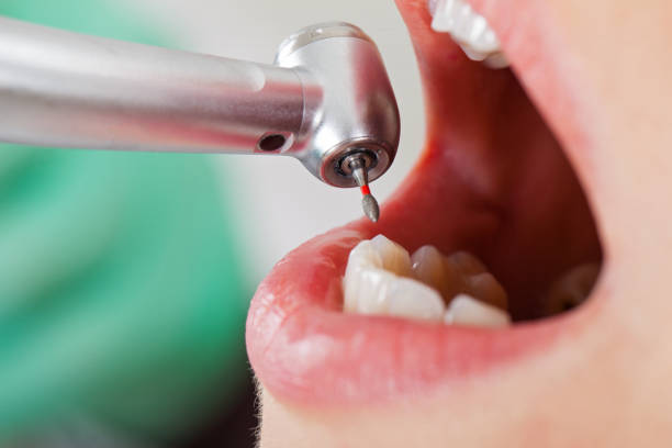 Best Orthodontic Emergency Dentist in Milford Square, PA